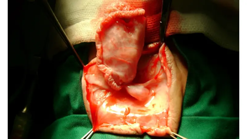 Pediatrik Beyin ve Sinir Cerrahisi — 2